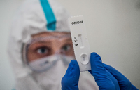 Ein Mediziner prüft einen Schnelltest zum Covid-19-Antikörper-Nachweis. Foto: dpa