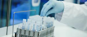 Ein Mitarbeiter hält in einem Coronatest-Labor PCR-Teströhrchen in den Händen. Eine neue Untervariante breitet sich aus.