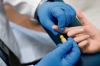 Im Labor wird einer Person Blut für einen HIV-Test entnommen (Symbolbild). Foto: dpa