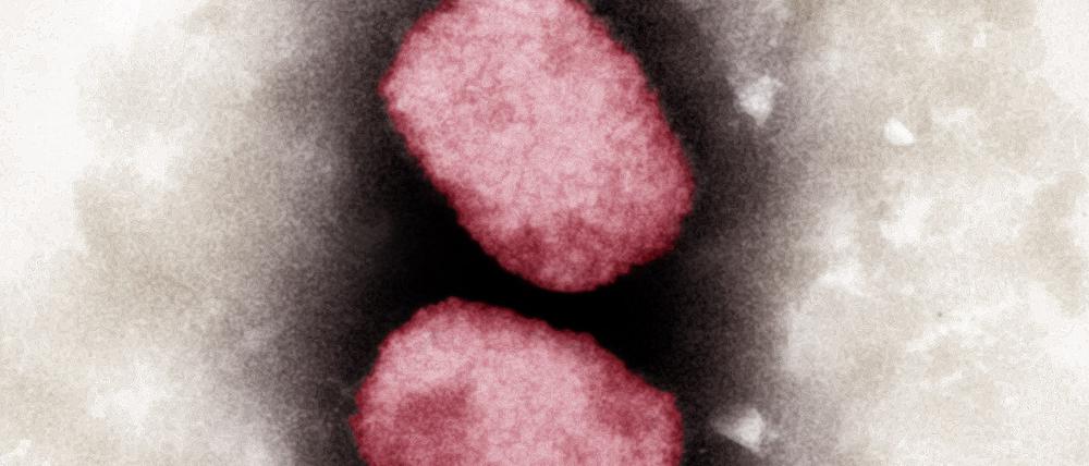 Elektronenmikroskopische Aufnahme von Affenpocken-Viren, koloriert. 