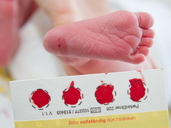 Der Dried-Blood-Spot-Test ist beim Neugeborenen-Screening etabliert. 